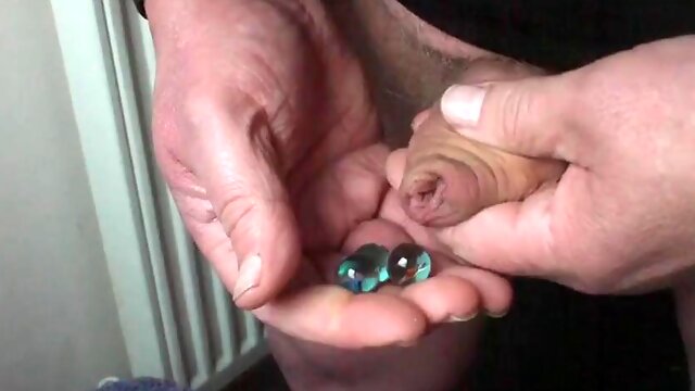 24 marbles in foreskin