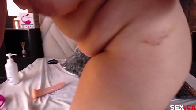 Anal
