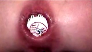 Extreme Insertion Anal