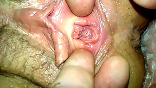 Close Up