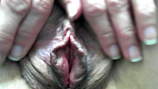 French Gyno