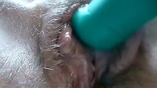 Insertion