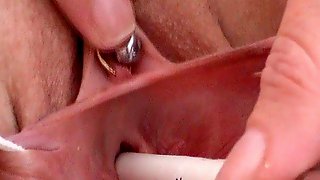Cervix