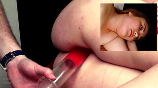 Inflation Du Ventre, Gode Gonflable Anal