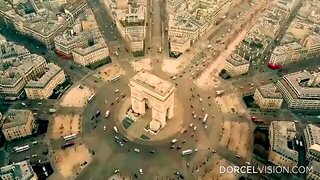 Cherry Kiss Sex, Hairy Anal, French, Lingerie