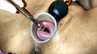 Cervix Insertions