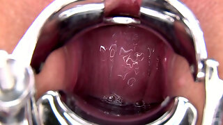 Speculum Close Up