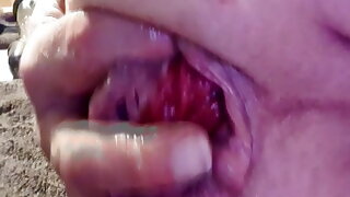 Prolapse Shemale