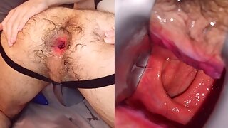 Speculum Gay