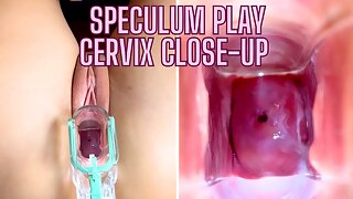 Cervix Play, Speculum, Gebärmutterhals, Nahaufnahme