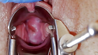 Speculum Orgasm, Orgasmus Vaginal, Muschi Speculum, Gyno Fetisch