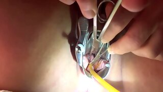 Cateter, Katheter Bdsm, Muttermund