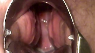  bbw masturbate with speculum show cervix contracting orgasm