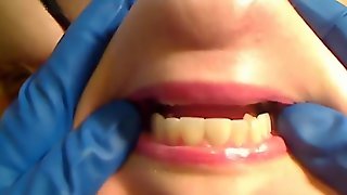 Gloved Mouth Exam