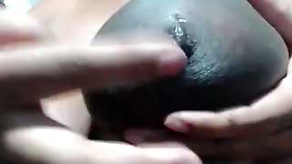 Dark Areolas