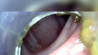 Deep deep anal again home colonoscopy endoscope part 1