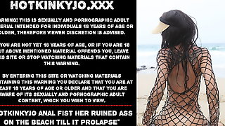 Hotkinkyjo anal fist her ruined ass on the beach & prolapse