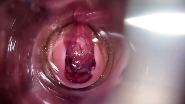 Cam Inside Pussy, Creamy Cervix, Cervix Close Up