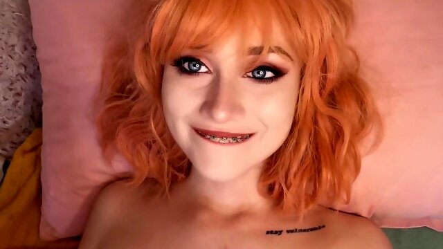 Wondrous Ache- Red-Haired Braceface