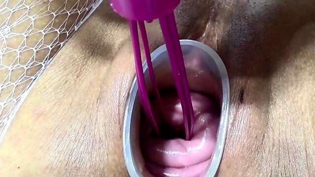 Mature wife fucking cervix and penetration in uterus