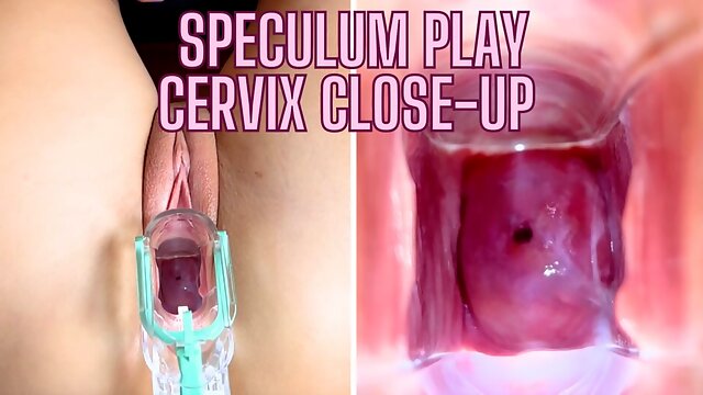 Speculum Cervix, Speculum Close Up
